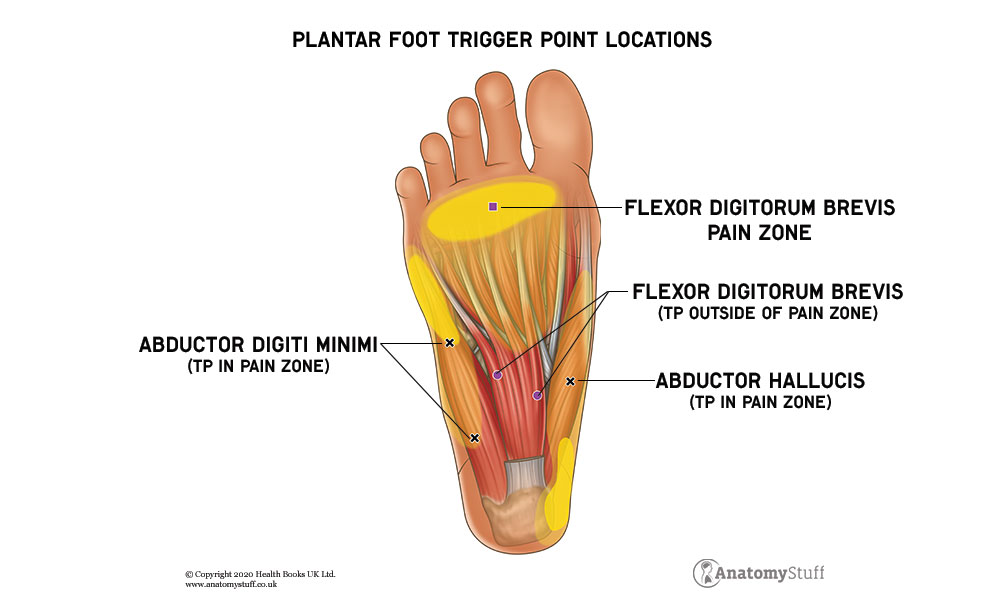 Understanding Trigger Points, Causes & Symptoms