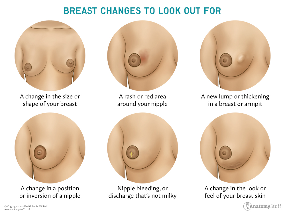 | How to check your breasts | AnatomyStuff